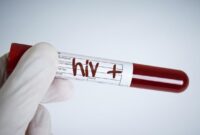 Eks Guru MTs di Depok Diduga Sudah Mengidap HIV Sejak 2014, Terkait Kasus Brosur ‘Jasa Oral Seks’