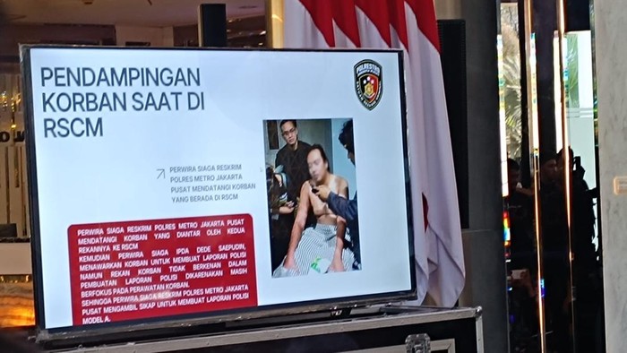 Kemenkes Pastikan Biaya Perawatan Andrie Yunus Korban Penyiraman Air Keras Ditanggung Penuh di RSCM